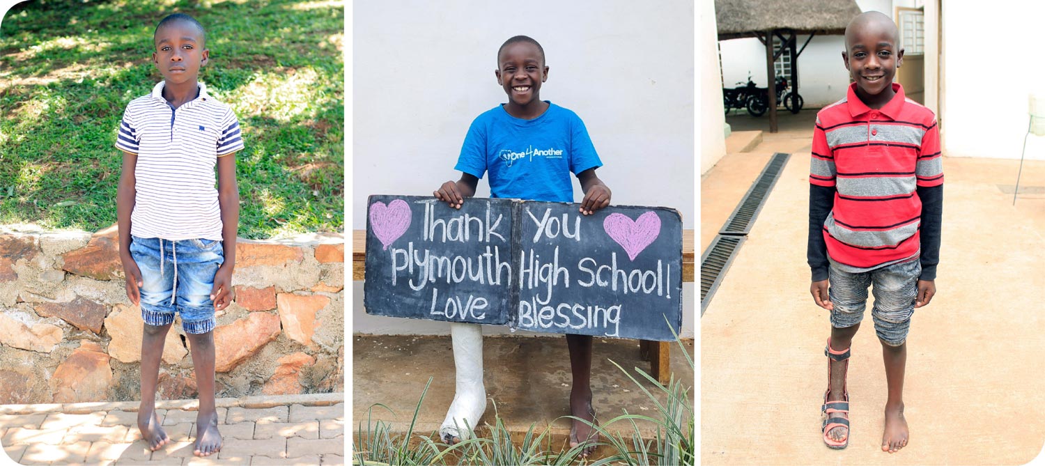 child before and after surgeries and holding sign with words Thank you Plymouth High School, Love Blessing